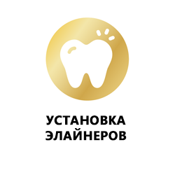 Выравнивание зубов элайнерами у взрослых Tallinn